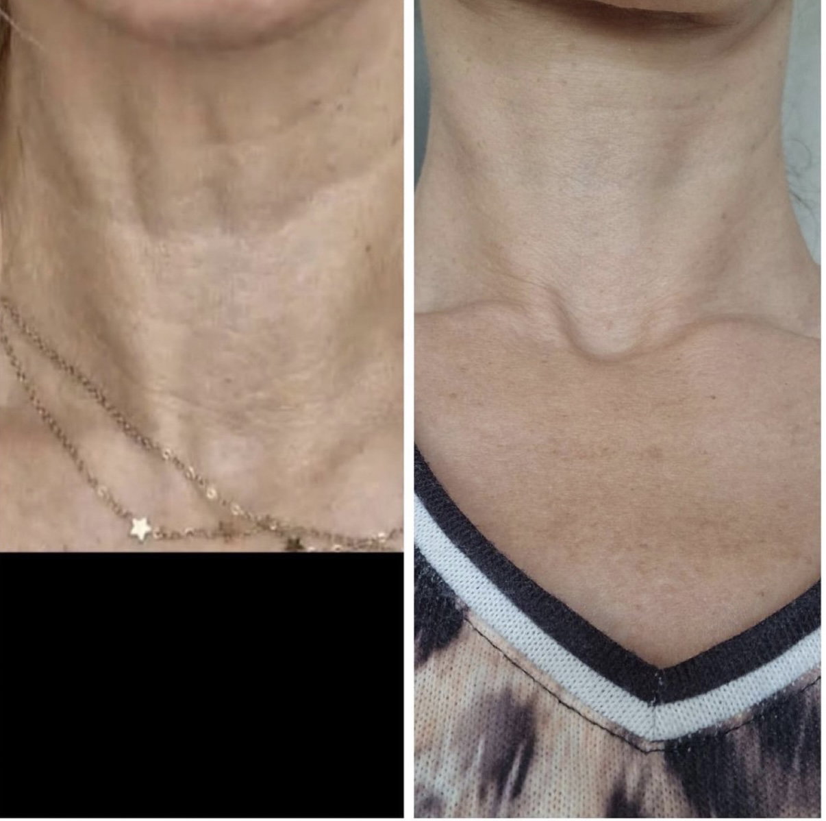 KRX Intensieve Neck Lift Creme 4